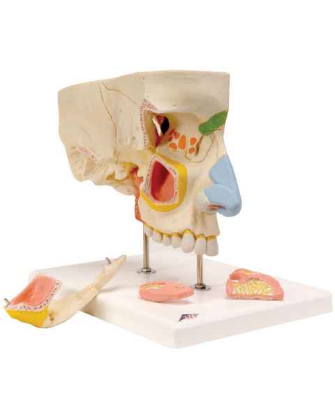 Nose Model with Paranasal Sinuses 5-Part