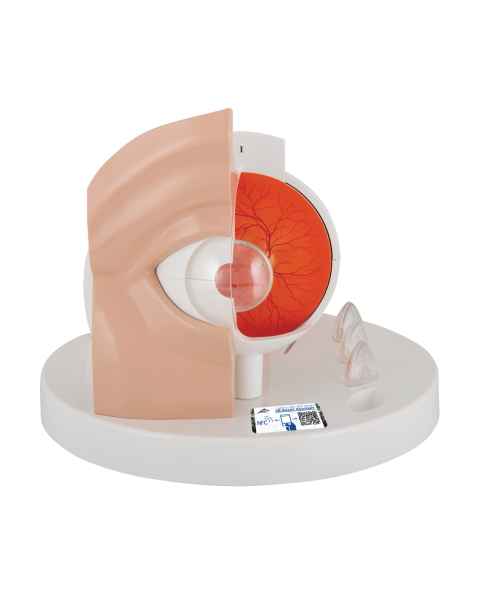 3B Scientific F17 Pathological Eye Model - 3B Smart Anatomy