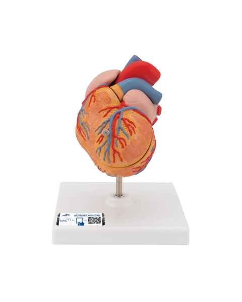 3B Scientific G04 Classic Heart Model with Left Ventricular Hypertrophy (LVH) 2-Part - 3B Smart Anatomy