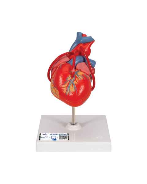 3B Scientific G05 Classic Heart Model with Bypass, 2-Part - 3B Smart Anatomy