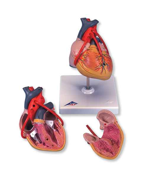 Classic Heart Model with Bypass 2-Part