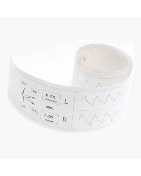 Huntleigh Healthcare Thermal Paper