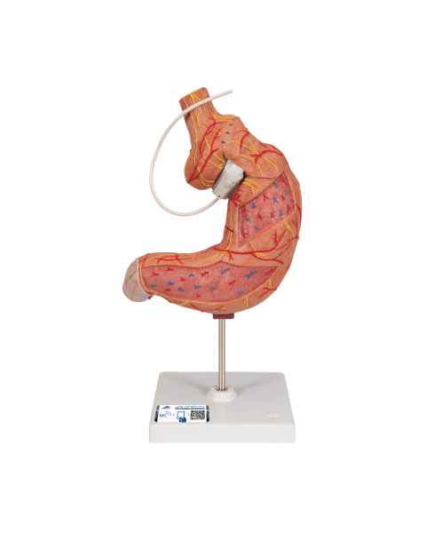 3B Scientific K15/1 Gastric Band Model