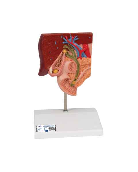 3B Scientific K26 Gallstone Model