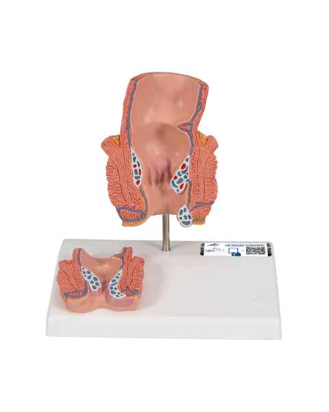3B Scientific K27 Hemorrhoid Model - 3B Smart Anatomy