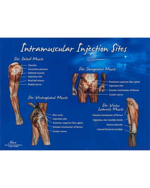 Life/form Intramuscular Injection Sites Chart