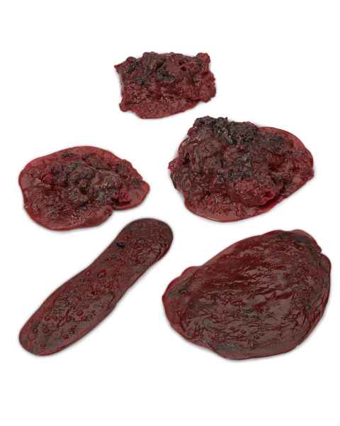 Life/form Moulage Wound - Simulated Clots and Hemorrhages - Set of 5