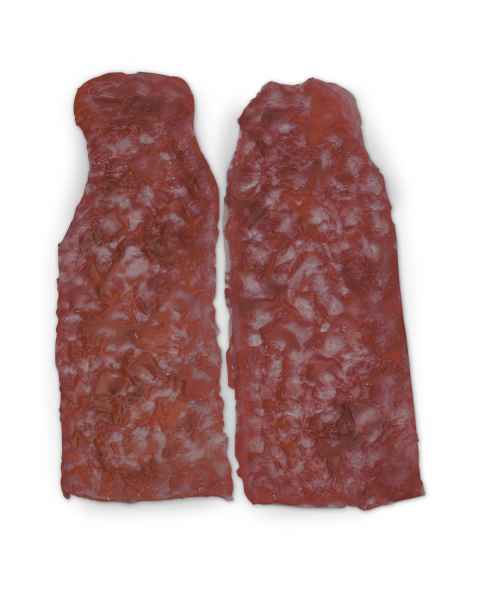 Life/form Moulage Wound - Simulated Arm Burns - Set of 2