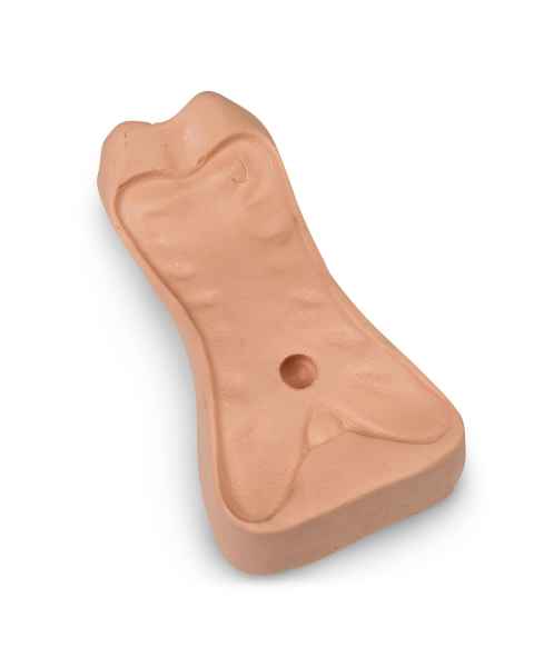 Replacement Sternum Insert