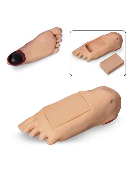 Life/form GERi and KERi Optional Edema Foot with Deep Tissue Injury - Light