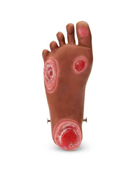 Life/form GERi and KERi Optional Pressure Injury Foot - Medium