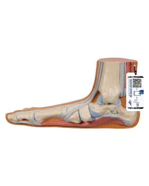 3B Scientific M31 Flat Foot (Pes Planus) Model - Light Skin Tone
