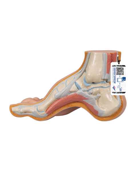 3B Scientific M32 Hollow (Pes Cavus) Foot Model - Light Skin Tone