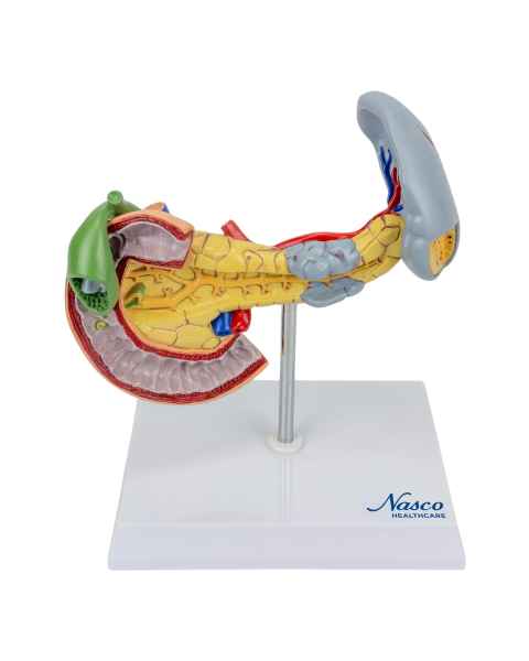 Nasco MG14742 Pancreas, Spleen, and Gallbladder with Pathologies Model - Front View
