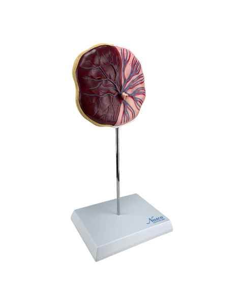 Nasco MG16212 Placenta Model - Angle 1