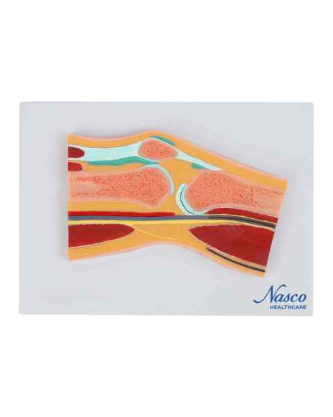 Nasco MG17222 Knee Model, Median Section - Front View