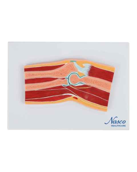 Nasco MG17225 Elbow Model, Median Section - Front View