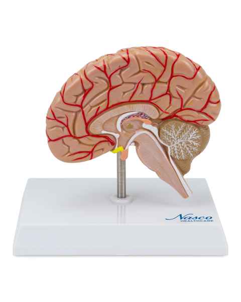 Nasco MG17228 Brain with Arteries Model - Angle 1