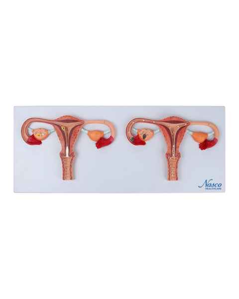 Nasco MG19471 Uterus with Fertilization Process Model - Angle 1