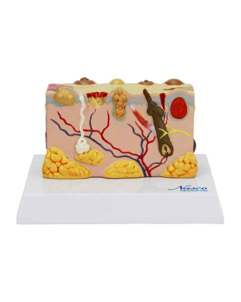 Nasco MG21065 Skin Section with Pathology Model, 30x Enlarged