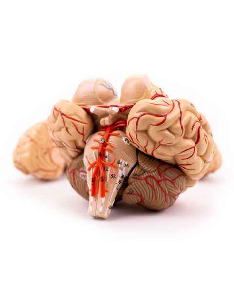 Nasco MG21717 Brain with Arteries Model, 9 Parts - Angle 1