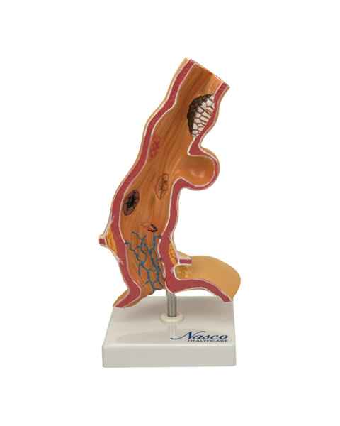 Nasco MG22729 Esophageal Disease Model, 5x Enlarged - Front View