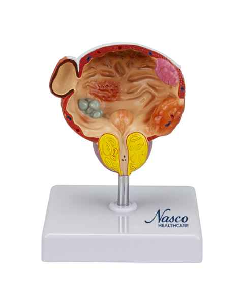 Nasco MG22730 Bladder and Prostate Diseases Model - Front View