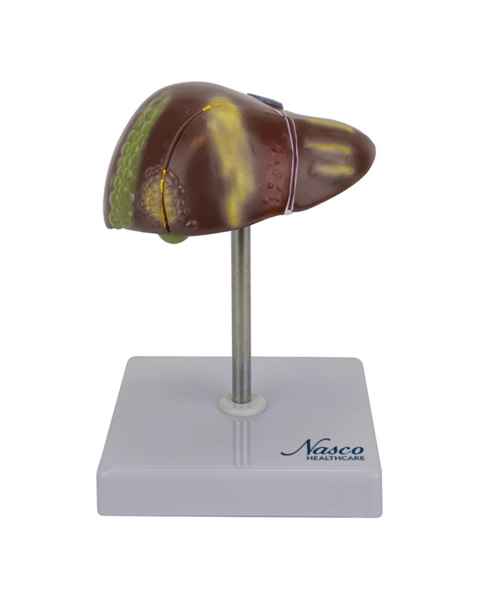 Nasco MG23415 Liver Section with Pathology Model, 2 Parts - Front View