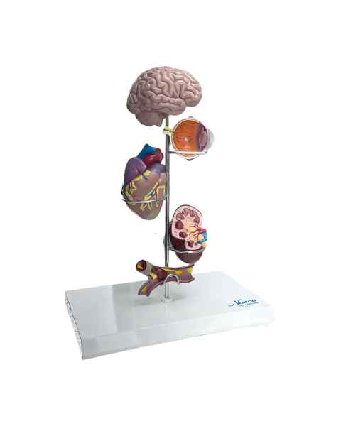 Nasco MG29749 Arterial Hypertension Model