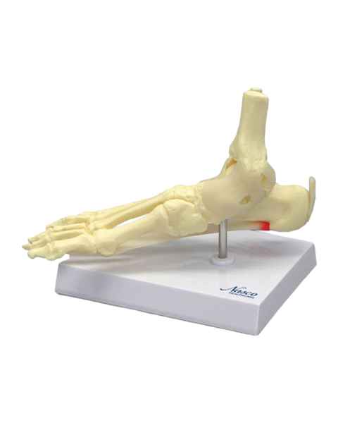 Nasco MG29758 Foot and Ankle with Plantar Fasciitis Model, Left Angle View