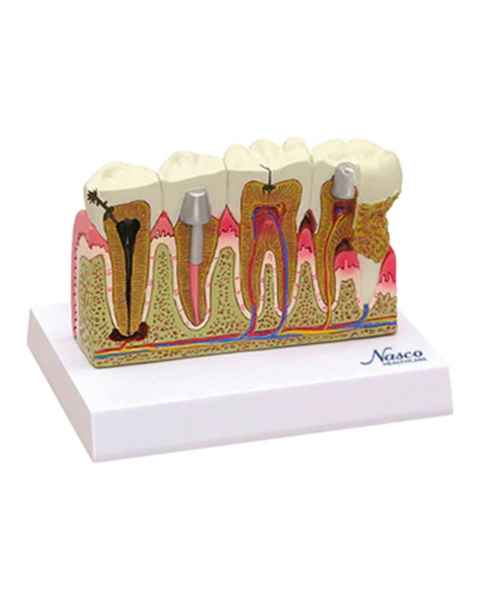 Nasco MG29771 Teeth Model