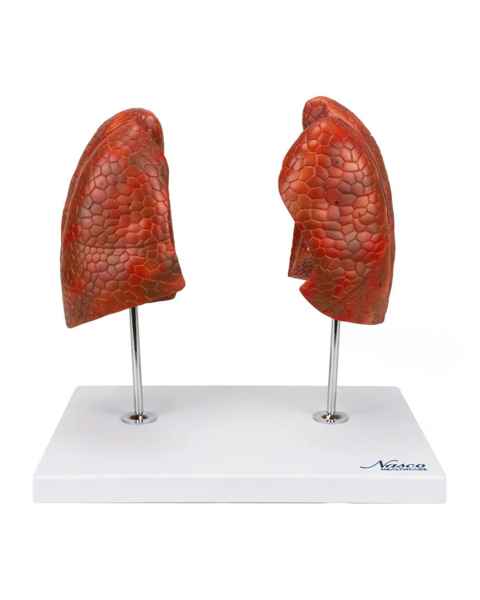 Nasco MG29786 Lung Model, 4-Part, Front View