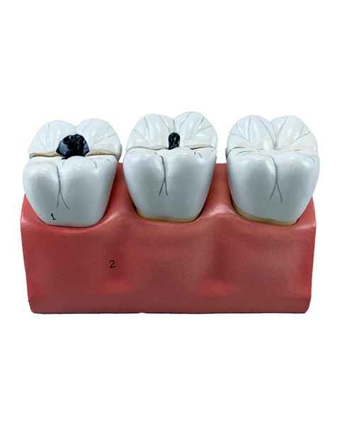 Nasco MG29837 Dental Morphology Model, 4x Enlarged, 7 Parts - Top View