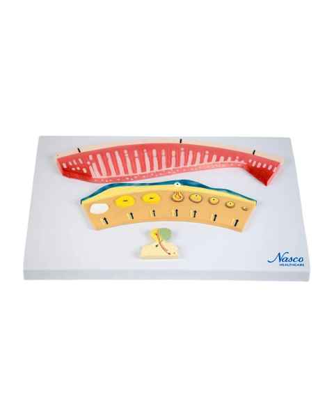 Nasco MG29725 Thyroid with Pathology Model, 4 Parts