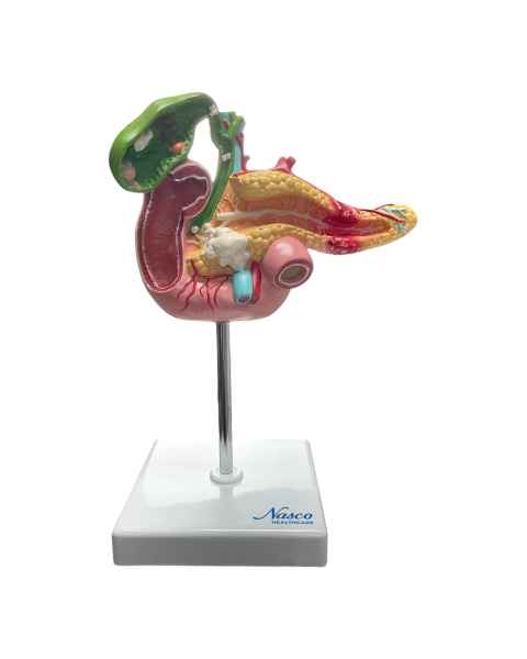 Nasco MG30031 Pancreas, Duodenum, and Gallbladder with Pathologies Model - Front View