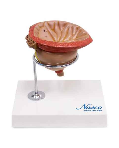 Nasco MG30752 Prostate Model, 2x Enlarged, 4 Parts