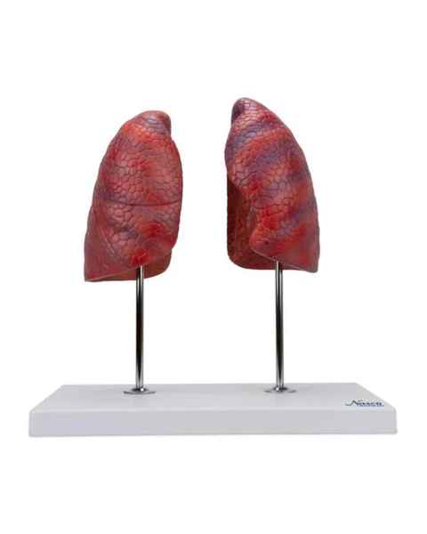 Nasco MG30887 Lung Model, 2-Part, Front View