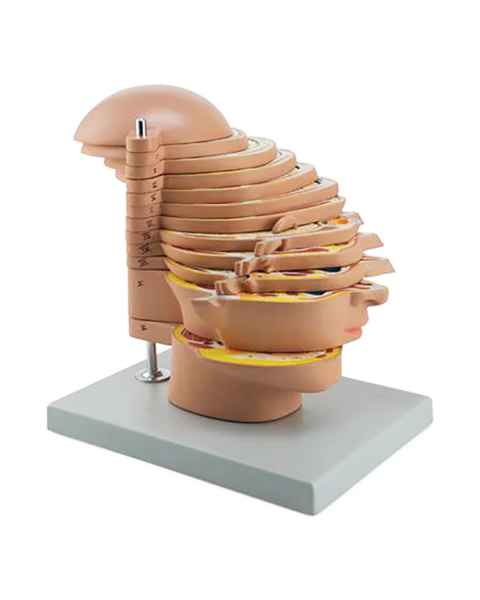 Nasco MG31094 MRI Head Model, 12 Transverse Parts