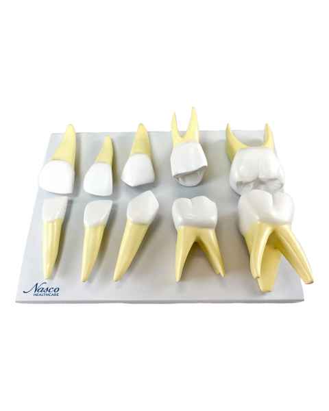 Nasco MG31150 Baby Teeth Model, 10x Enlarged