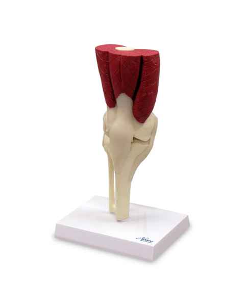 Nasco MG34917 Knee with Muscles Model - Front View