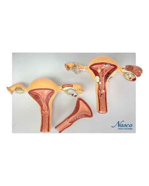 Nasco MG35528 Healthy and Pathological Uterus Models - Top View