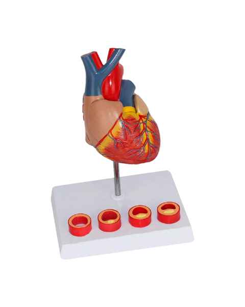 Nasco MG35530 Heart with Arteriosclerosis Model