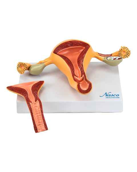 Nasco MG36026 Uterus with Ovary Model, 2 Parts - Front View