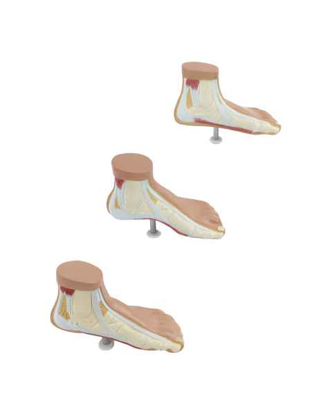 Nasco MG36149 Children's Foot Anatomy Model, Set of 3