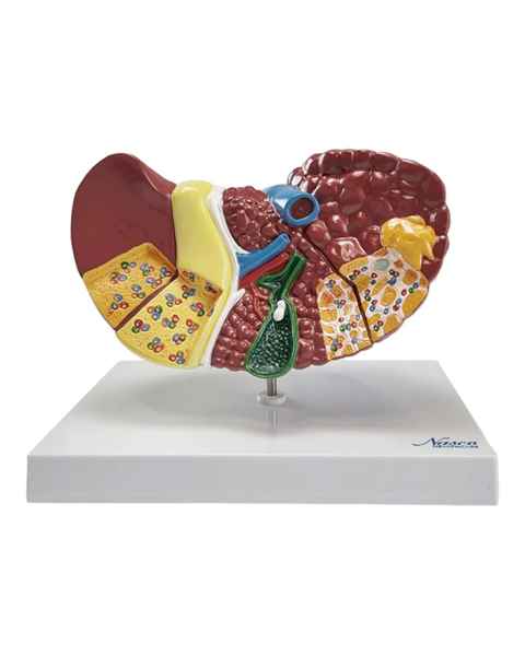 Nasco MG36908 Liver Section with Pathologies Model - Front View