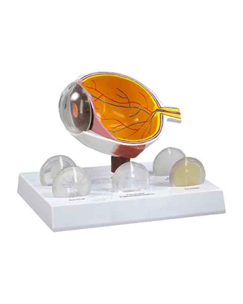 Nasco MG38396 Eye with Cataract Model