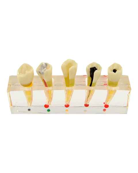 Nasco MG39443 Endodontics Dental Model, 5 Parts - Front View