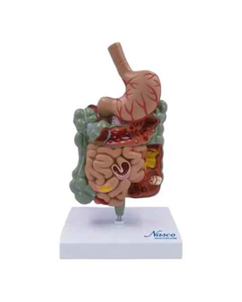 Nasco MG39708 Gastrointestinal Tract with Pathologies Model