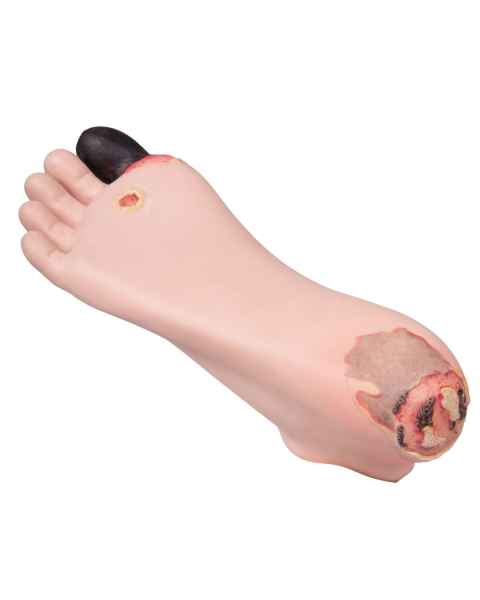 Decubitus Foot Treatment Trainer