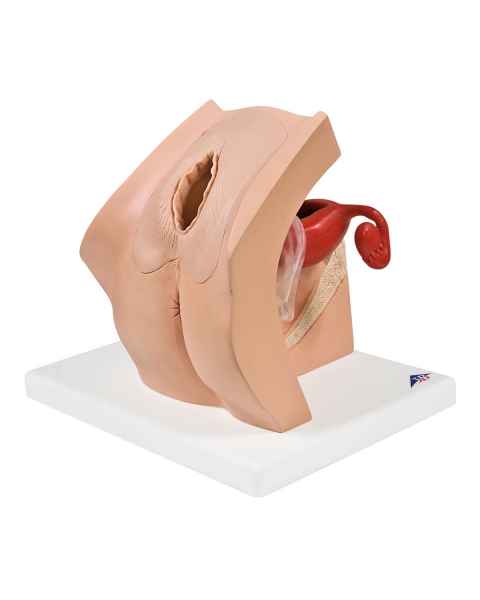 Gynecological Patient Education Model